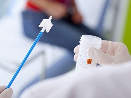 Phát hiện ung thư đường niệu dựa trên việc xét nghiệm nước tiểu dựa trên gen